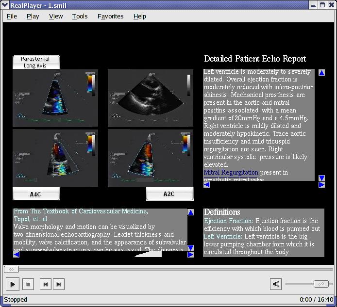 Coordinated Multimedia Summary (CMS)