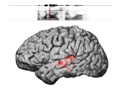 Cortical responses to speech sounds —Image courtesy of UCSF Cortical responses to speech sounds
—Image courtesy of UCSF