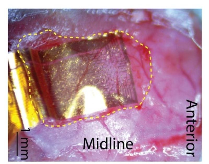 The Gelinas lab has used NeuroGrids in animals to discover new types of brain activity involved in learning and memory.