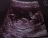 IANNA11W5D