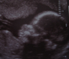 IANNA19W2D
