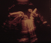 IANNA27W1D