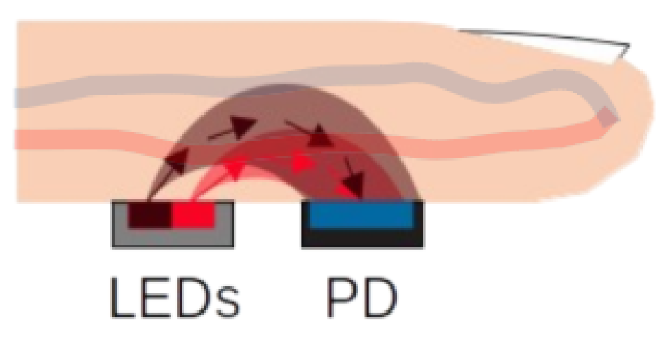 Illustration of Reflective PPG