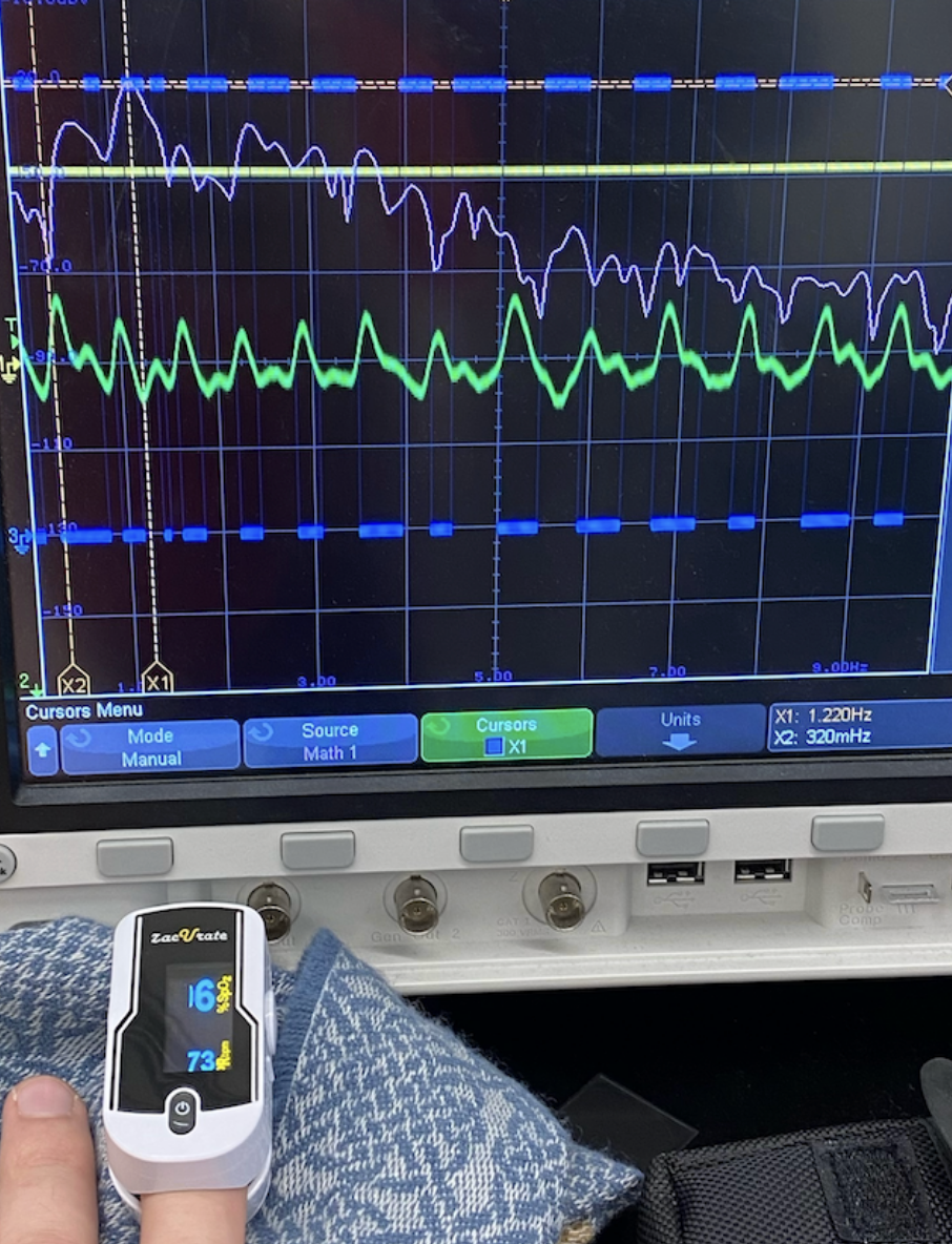Comparing Chip's Performance to Commercial Sensors
